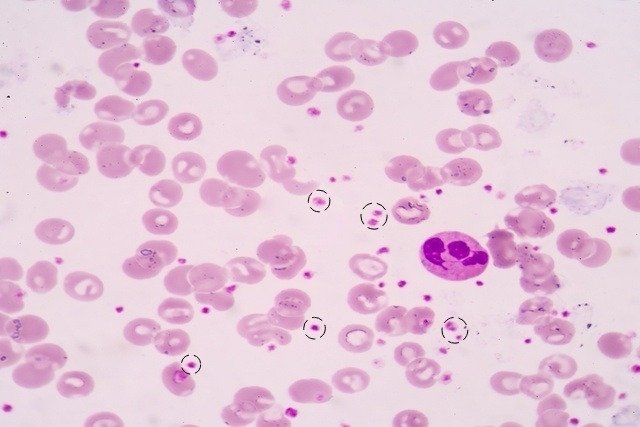 Мазок крови, на котором видны выделенные тромбоциты